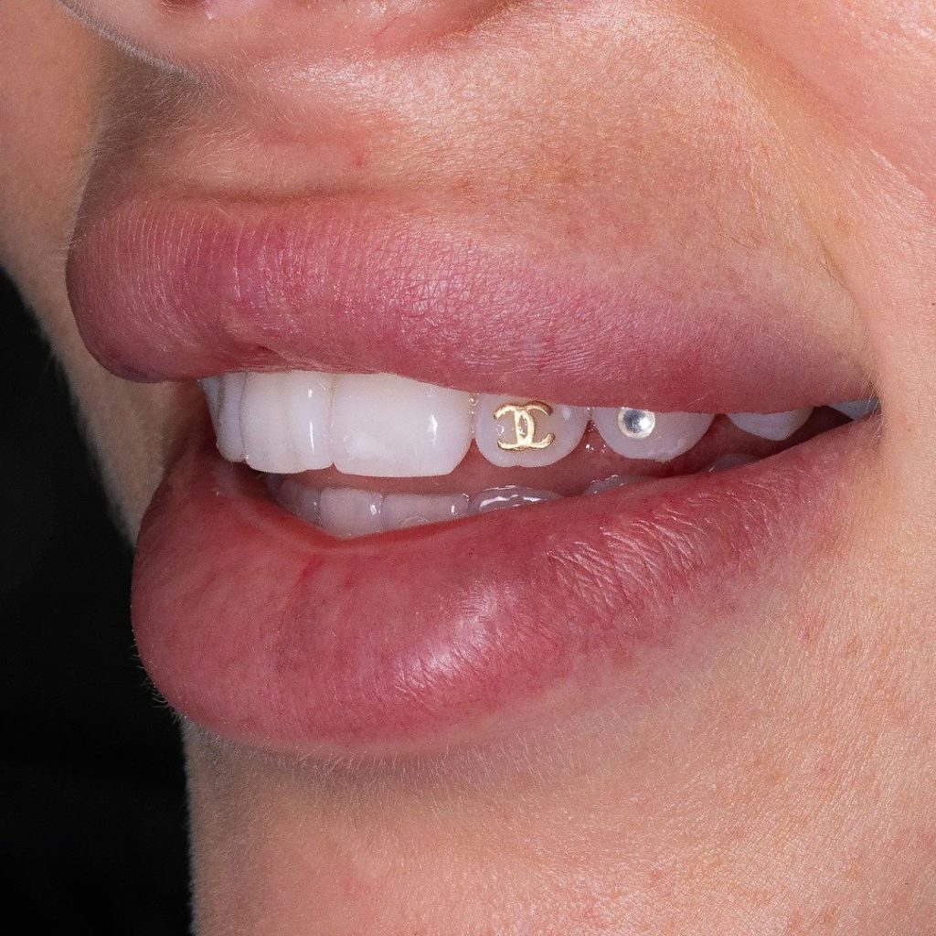 Tooth Gems - Gold Coast Dental Studio